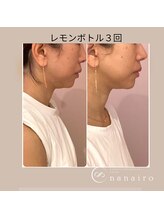 ナナイロ(nanairo)/