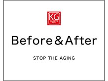顔ジム 麻布店/Before＆After