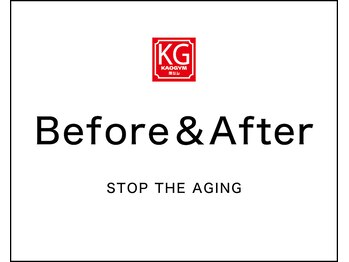 顔ジム 麻布店/Before&After