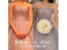レアル神戸 三宮店の雰囲気（食事管理とインディバで土台を整えた先に、写真で差が出る変化へ）