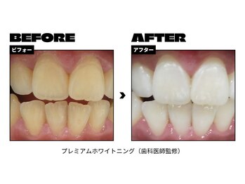 トムズ(Tom’s)/