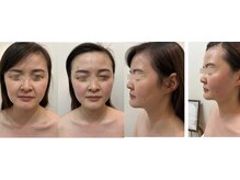 エクリア(Eclia)の雰囲気(千葉中央/京成千葉/小顔/コルギ/筋肉引き締め/法令線/たるみ)