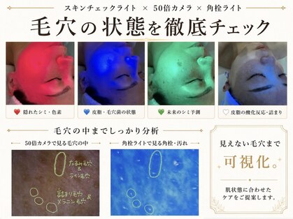 ステラ(Stella)の写真