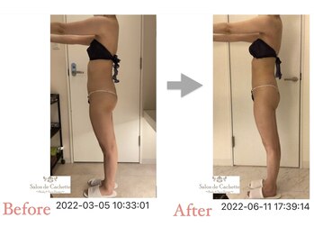 サロン ド カシェット 銀座/お客様のビフォーアフター例