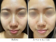 ビボーラ(BEBEAURA)/☆スペシャルプログラム☆