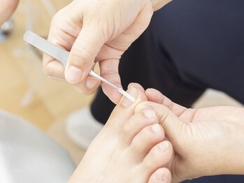 楽ーん/ドイツ式巻き爪矯正BSスパンゲ☆