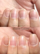 マリーロール 淀屋橋本店(Marie Laure)/自爪育成/深爪矯正/ネイルケア
