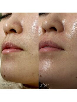 ネイルサロン タイムズスクエア 梅田店(Nail Salon Times Square)/フェイスワックス