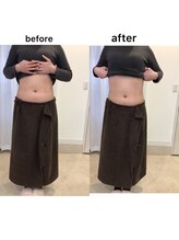 ジョワイユ(Joyeux)/腸の位置でお腹は変わる