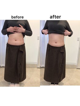 ジョワイユ(Joyeux)/腸の位置でお腹は変わる