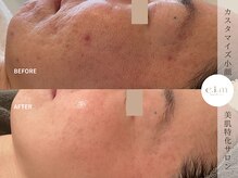 エイム(e.i.m)/40代：肌荒れ改善/たるみケア