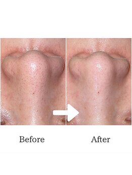 グラシア(gracia)/シミ・毛穴ケア専門店gracia