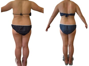 アンドゥ 津田沼(Undo)/浮腫みを撃退！