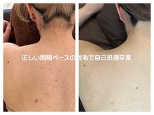 ルミエールブランシュ(Lumiere blanche)の雰囲気（《全身脱毛》毎日の自己処理から卒業！）