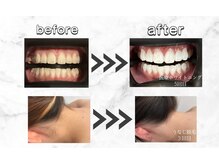 セルフダック 滋賀守山店(SELFDUCK)