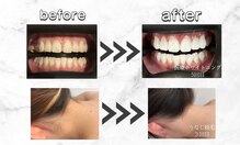 セルフダック 滋賀守山店(SELFDUCK)