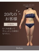 レディラック 大阪梅田本店(Lady Luck)/がっつりサイズダウンコース