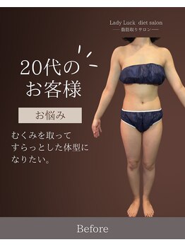 レディラック 大阪梅田本店(Lady Luck)/がっつりサイズダウンコース