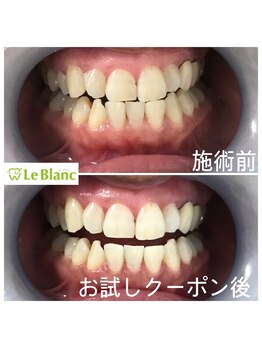 ルブラン 奈良店(Le Blanc)/ご新規のお客様