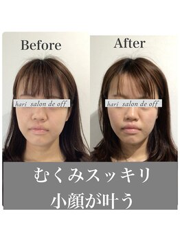 ハリサロンドオフ 心斎橋店(hari salon de off)/むくみスッキリ☆小顔叶う