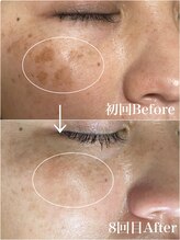 アッシュ(Ash)/トラブル撃退！！