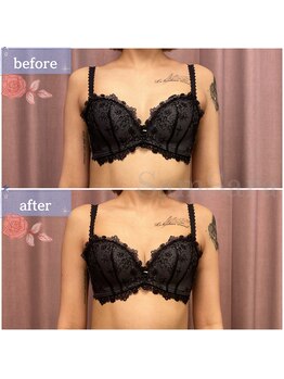 サムサラ(SamSara)/BeforeAfter/バストボリューム