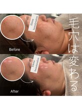 エレナ(Elena)/毛穴ケアが得意なサロンです