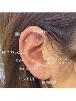 アールラッシュ(R-LASH)/