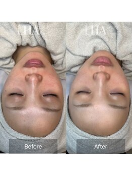 ルミナスアイ(Luminous Eye)/【LHALA PEEL】~ララピール~