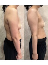 ブリア 横浜(BRILLA)/バストアップで姿勢まで改善？