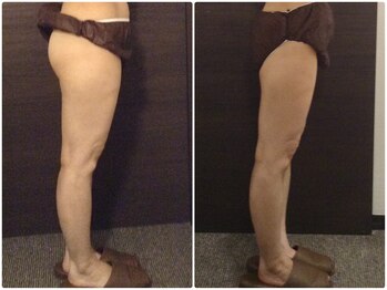 美容整体ウェリナ 名駅院/小顔矯正/骨盤矯正/美脚サロン