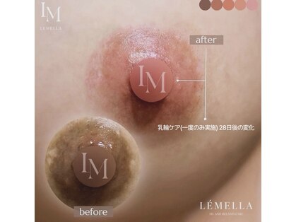 完全個室プライベートSalon MIRINO【ミリノ】の写真