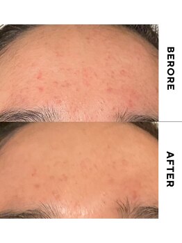 ゼロ 水戸店(ZERO)/ダクトピール