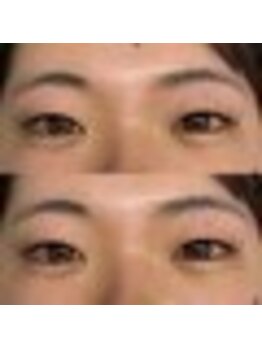 バニーアイズ 天神(Bunny eyes TENJIN)/フラット120本