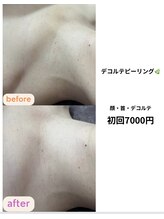 サクラ(SAKURA)/デコルテのお手入れ♪