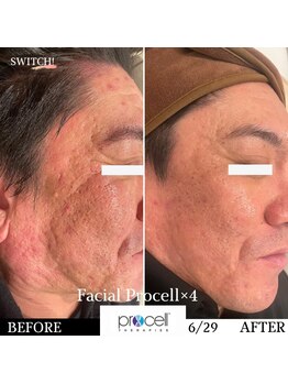 スイッチ(SWITCH!)/公式アカウントに掲載症例！！