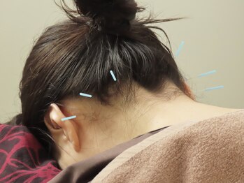 カイラス鍼灸院/