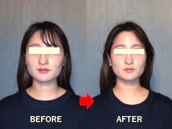 アトラス/初回のお客様のBefore＆after