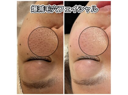 リリーガーデン(Lily Garden)の写真
