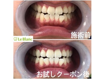 ルブラン 奈良店(Le Blanc)/ずっとマスクで隠してませんか?