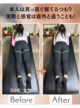 ウェルビーイング整体院 水戸赤塚店(wellbeing整体院)/Before After