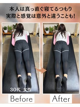 ウェルビーイング整体院 水戸赤塚店(wellbeing整体院)/Before After