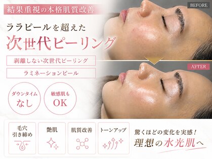 オンフリーク(ON FLEEK)の写真