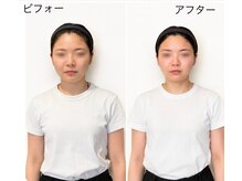 リフェイス(RE:FACE)