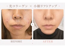 パールプラス 日立店(Pearl plus)/肌土台が整い小顔リフトアップ◎