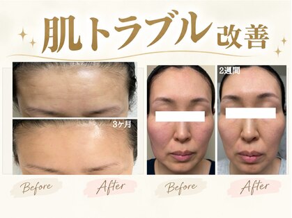 シャルナ(charna)の写真