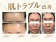 シャルナ(charna)の写真