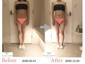 サロン ド カシェット 銀座/お客様のビフォーアフター例