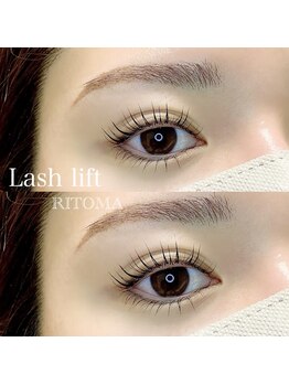 リトマ(RITOMA)/ラッシュリフト 上下