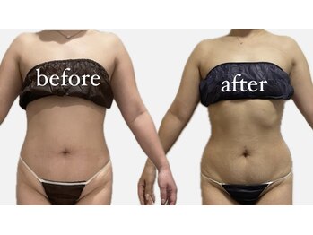 フローレンス(Florence)/20代○○さんの変化